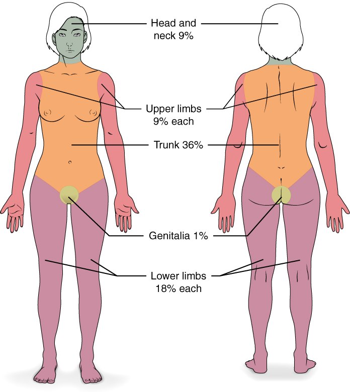 OpenStax rule of nines chart, front and back: head and neck 9 percent, upper limbs 9 percent each, trunk 36 percent, genitalia 1 percent, lower limbs 18 percent each