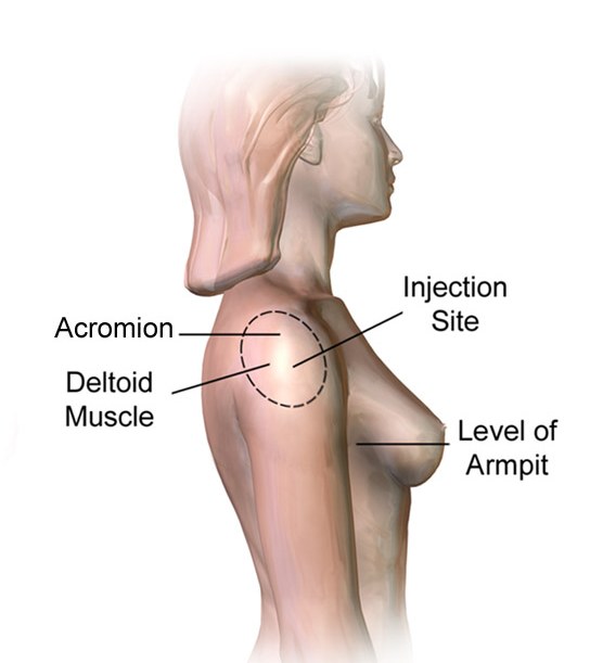 Blausen illustration of the deltoid injection site, labeled with the acromion, deltoid muscle and level of the armpit